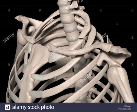 Digital Medical Illustration Depicting A Fracture Of 1st Rib True