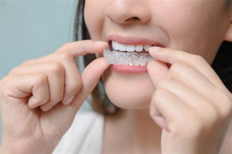 Finding An Invisalign Dentist Near Me Burbank Cosmetic Dentist