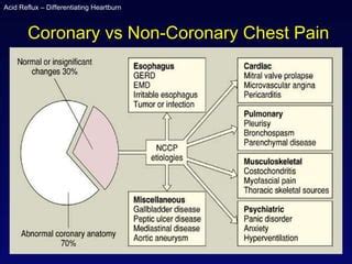 Non cardiac chest pain