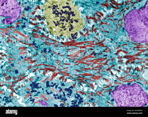 False Colour Electron Microscope Micrograph Showing Melanin Granules