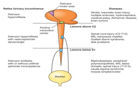 Alterations Of Renal And Urinary Tract Function Flashcards Quizlet