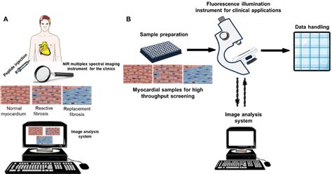 Schematics Illustration Of Near Infrared Nir Fluorescence Imaging Of