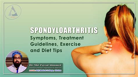 Spondylarthritis symptoms treatment Guideline, Exercise And diet tips II Dr. Md. Faysal Ahmmed ...