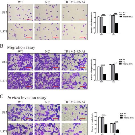 Knockdown Of Trem In Glioma Cells Reduced Tumor Growth In Vivo A U