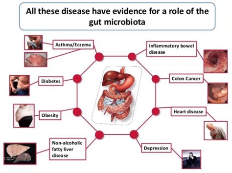 Friends who live in our Gut: Gut Microbiota | Science And Samosa