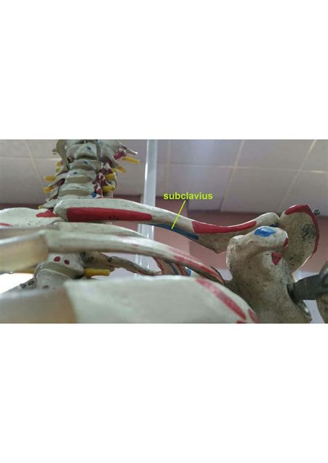 Solution Muscles Of Upper Limb Studypool