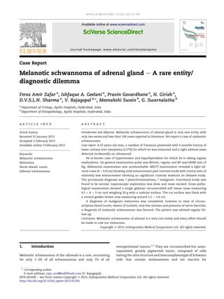 Melanotic Schwannoma Of Adrenal Gland A Rare Entity Diagnostic