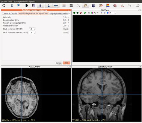 How To Use The Brain Extraction Tool