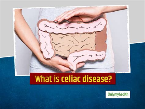 Celiac Disease Symptoms Causes Diagnosis Risk Factors Diet And Treatment