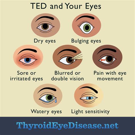 How Are the Eyes Affected By Thyroid Eye Disease (TED)?