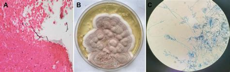 Microscopic findings, fungal colony morphology, and slide culture ...