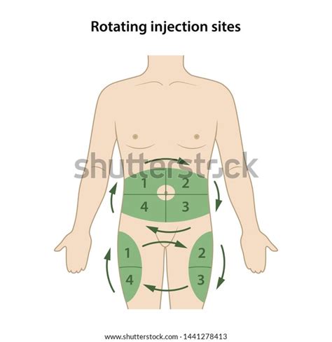 Diabetes Circle Injection Sites Shown On Stock Vector (Royalty Free ...