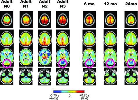 Propagation Analysis Of The Resting State Fmri Bold Signal In Adult