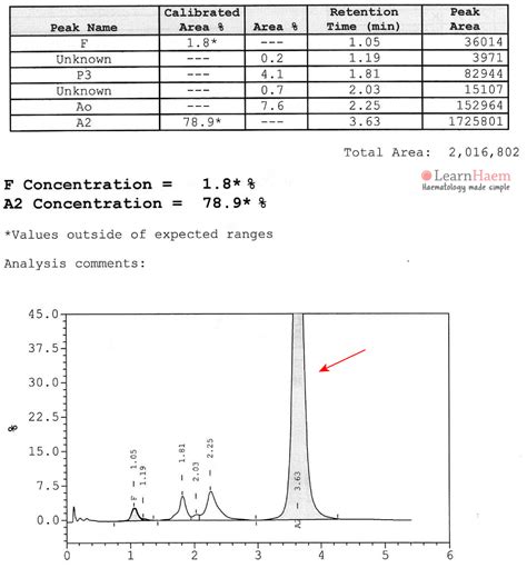 Haemoglobin E Learnhaem Haematology Made Simple