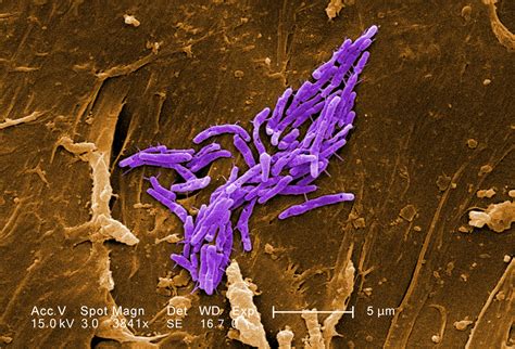 Mycobacterium fortuitum (SEM) - DocCheck