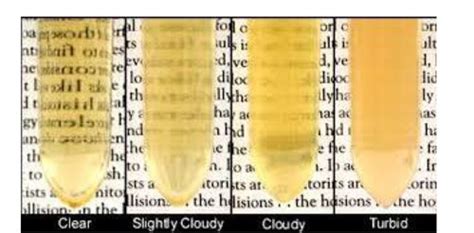 Urinalysis Flashcards Quizlet