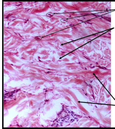 dense irregular connective tissue Diagram | Quizlet