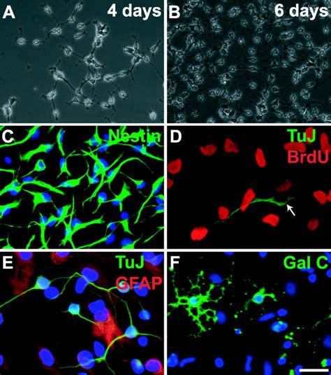 Morphological And Immunocytochemical Characterization Of Neural