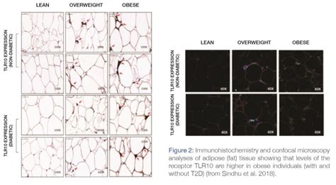 Fat Tissue And Metabolic Inflammation - DDI