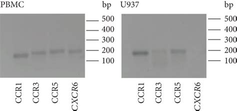 Signaling Via Chemokine Receptor Ccr1 A The Mrna Expression Of