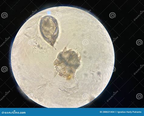 Notoedres Cati Under The Microscope Notoedric Mange Also Referred To As Feline Scabies Stock