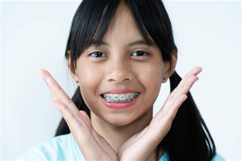 Why To Avoid Fake Braces And Look For Safer Alternatives Thurman