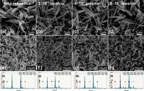 The Morphological And Elemental Analysis Of HAp Coatings A D Low And