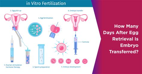 Blastocyst Culture In IVF Benefits And Drawbacks Nova IVF Fertility