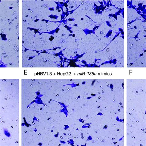 The Effects Of Mir A On Cell Invasion Of Hcc Cells A Hepg B