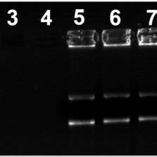 Electrophoretic Separation 0 8 Agarose Gel Of Naked A And