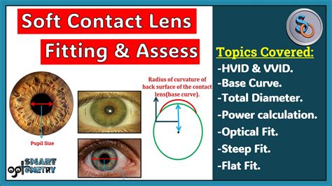 Spherical Soft Contact Lens Fitting And Assessment Smart Optometry