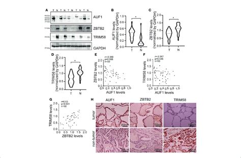 Auf Zbtb And Trim Expression In Normal And Tumoral Human