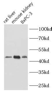 Neu Antibody Finetest Elisa Kit Finetest Antibody Finetest