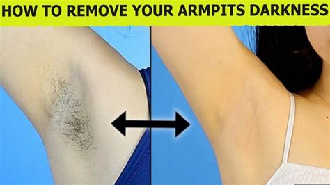 How To Remove Armpits Hair Permanently Remove Unwanted Body Hair