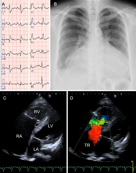 Figure Multi Modal Imaging Demonstrating The Findings In The Present