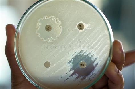 Testes De Droga Da Microbiologia Imagem De Stock Imagem De