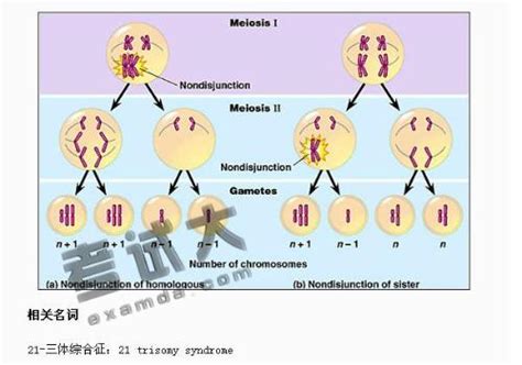 21 三体综合征 搜狗百科