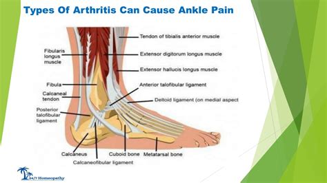 Ppt Foot And Ankle Pain Causes Exercises Treatments Powerpoint