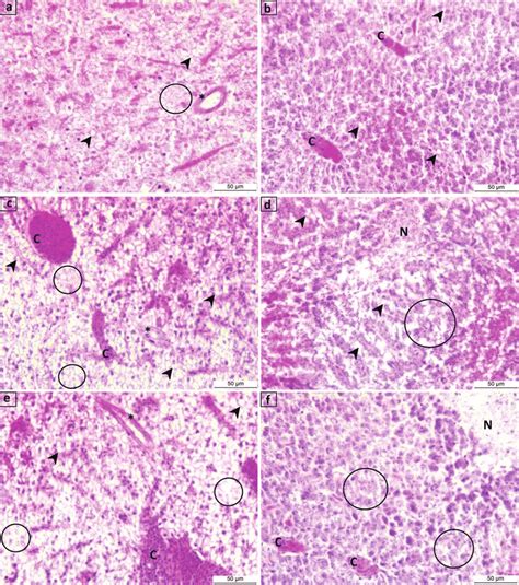 histopathological effects  endothall   livers  zebrafish
