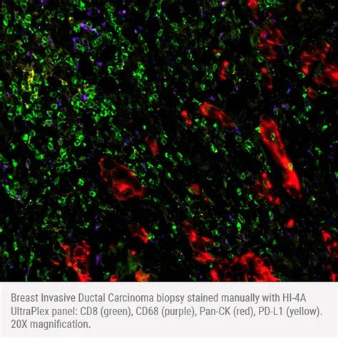 Hi 4a Multiplex Panel Human Cd8 Cd68 Pan Ck Pd L1 Ultraplex Human Fluorescent Panels