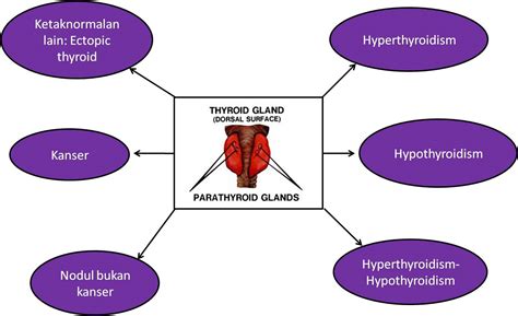 Apakah Fungsi Kelenjar Thyroid Dan Ketaknormalan Yang Boleh Terjadi