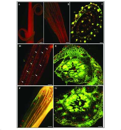 Confocal Laser Scanning Micrographs Images Showing Gfp Tagged Strains