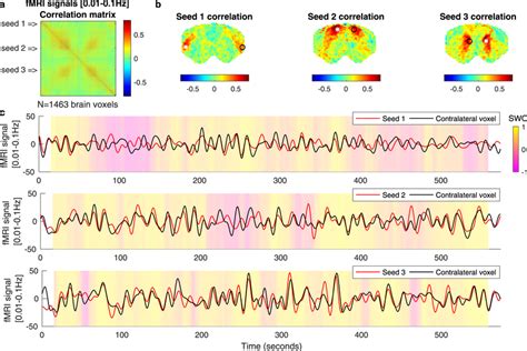 Static And Dynamic Resting State Functional Connectivity Analysis In