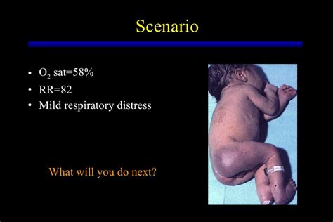 Cyanotic Heart Disease