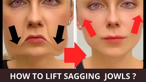 Face Exercises For Jowls Laugh Lines Nasolabial Folds Saggy Skin