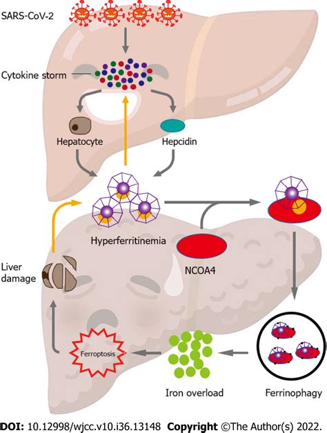 Liver Injury In Covid Holds Ferritinophagy Mediated Ferroptosis