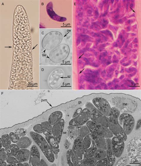 Sarcocystis Cymruensis Stages A Part Of Sarcocyst From Leg Muscle Of A Download Scientific