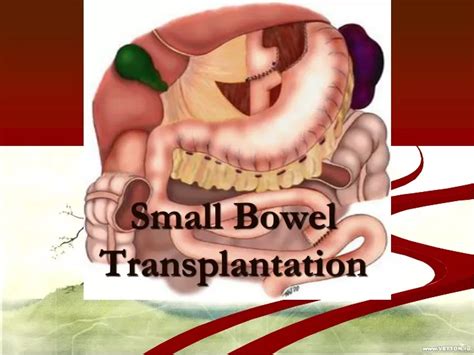 PPT - Small Bowel Transplantation PowerPoint Presentation, free download - ID:9728038