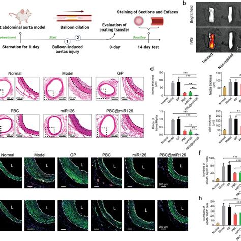 In Vitro Huvecs Behaviors And Coculture Of Huvecs Hasmcs Human