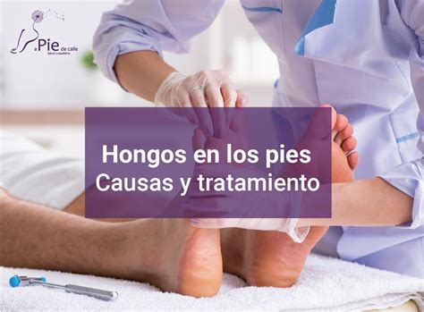 Hongos En Los Pies Causas Y Tratamiento